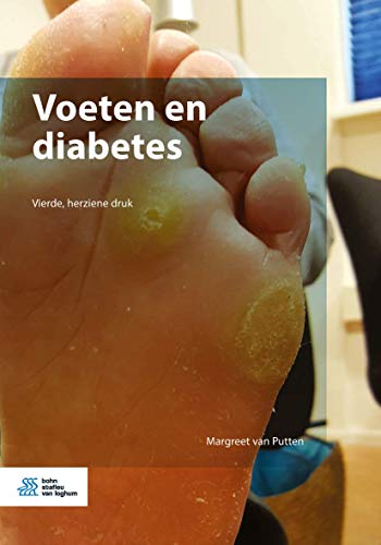 Voeten en diabetes - down 5.16% (£1.24) to £22.77 from £24.01